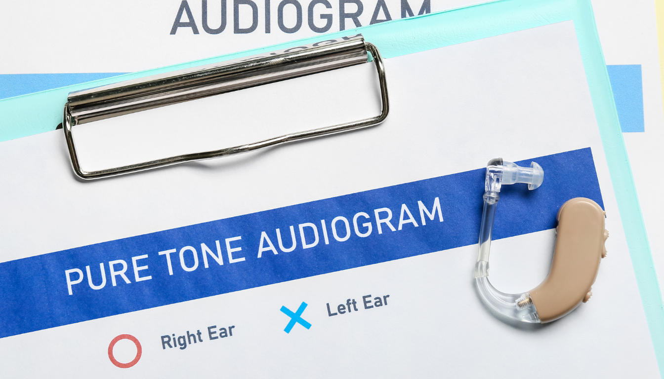 Menieres sygdom og audiogrammer: forstå sammenhængen mellem symptomer og diagnose - Illustration