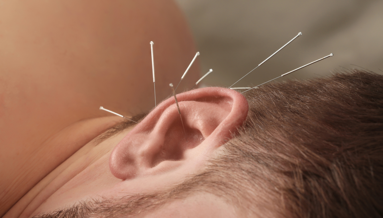 Sudden deafness akupunktur: kan nålene genskabe hørelsen? - Illustration