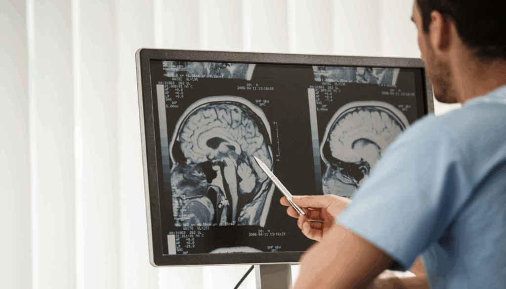 Acusticusneurinom symptomer: de skjulte tegn du bør kende - Illustration