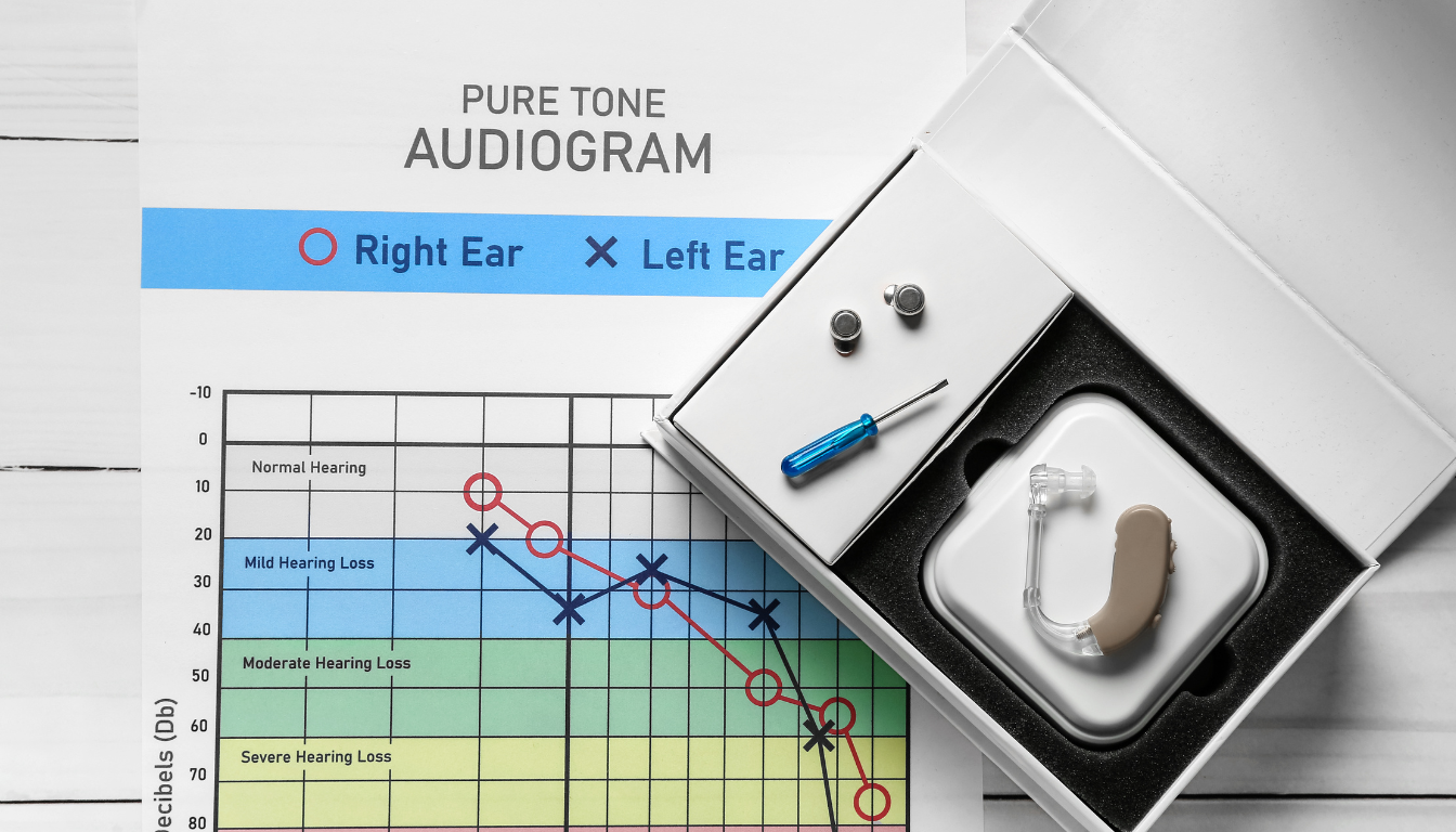 Audiogram db: forstå dit høretestresultat og decibelmålinger - Illustration