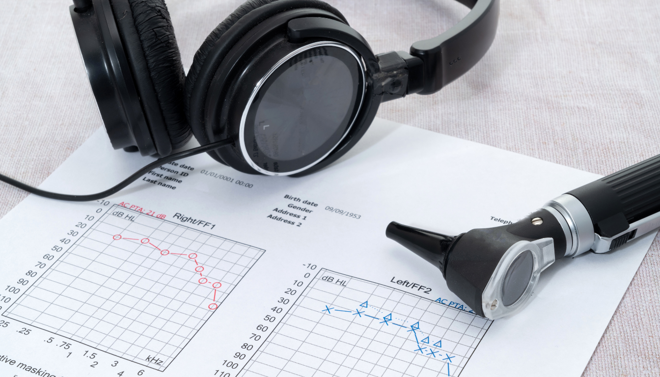 Otosklerose og audiogrammer: forstå diagnosen gennem lydens kurver - Illustration